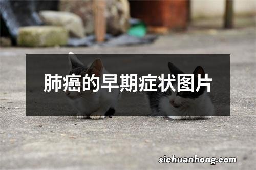 肺癌的早期症状图片