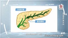 大熊猫宝新因急性重症胰腺炎离世 那么人该怎么预防胰腺炎？