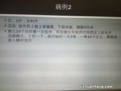 婴儿痉挛千万别大意，记住6个特点，及时治疗才能减少后遗症