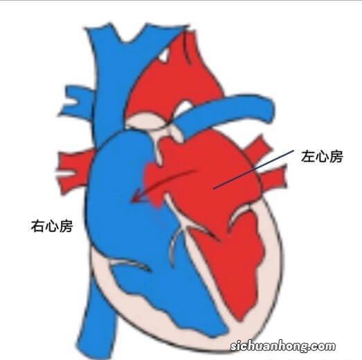 我的宝宝感冒后，检查发现得了“心漏症”，该怎么办？