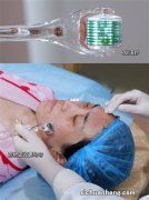 打水光针效果如何？