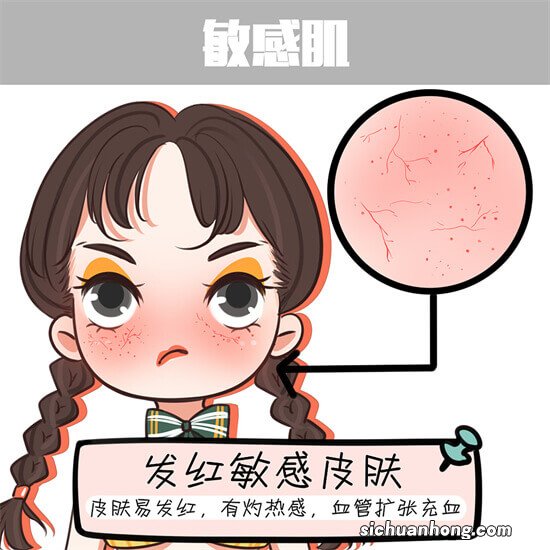 ?换季为什么会导致人过敏呢