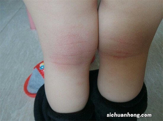 农村常见的一种植物,是刚出生宝宝的福音,城里人想买都买不到