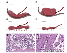 胎盘：一个奇特的器官