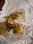 儿童拉肚怎么办？