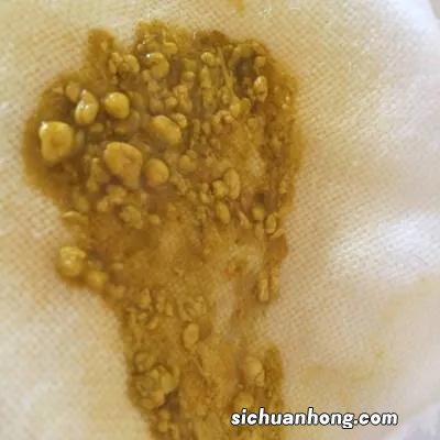 宝宝绿便不焦虑！这篇科普让你秒懂