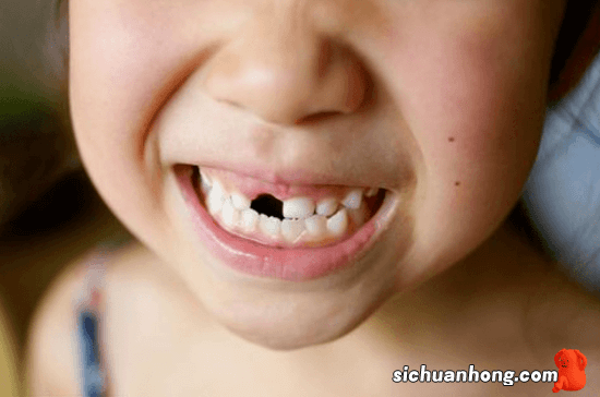 宝宝出牙迟是什么原因？