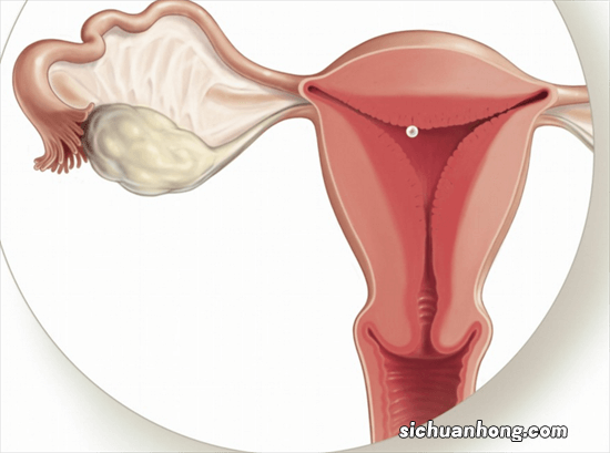 医生：女性月经结束后，4种异常频繁出现，赶紧检查HPV