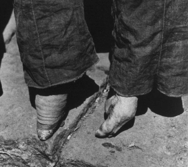 在古代女人的这个部位绝对不能让男人看到，自己的丈夫也不行