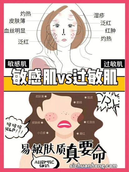 皮肤易过敏怎么办？11招远离皮肤伤害