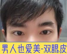 男士也做双眼皮吗
