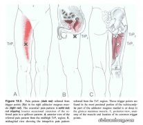 同房后大腿内侧疼痛怎么回事？预防动作记住这几个