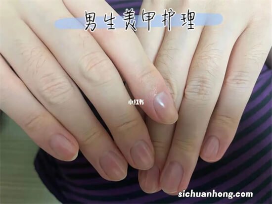 医院护士可以美甲吗 医院护士美甲有什么影响