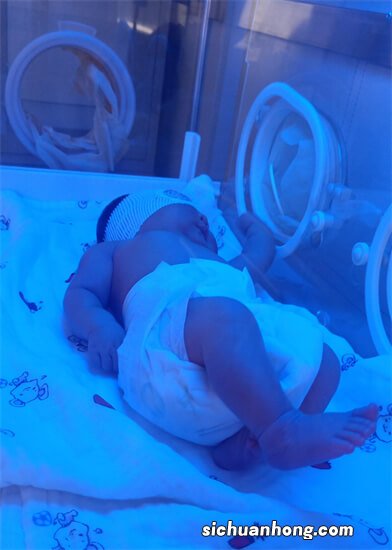 仅11天婴儿照蓝光惨死！新生儿黄疸必须照蓝光？别被忽悠了