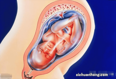 孕期千万不能去哪些地方？