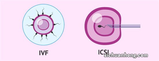 苦命的不育夫妻哟，医生不给你做三代试管为哪般？