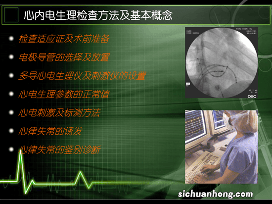 军检和民航飞行员心电图标准一样吗?体检应该注意哪些事项?