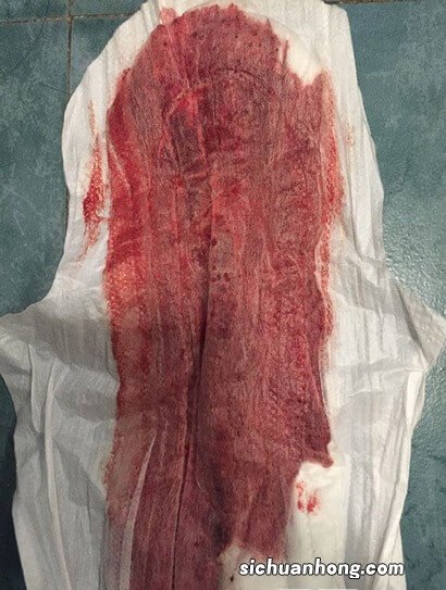 女人来大姨妈,你知道要流多少血吗?