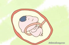 这么做再也不怕胎儿脐带绕颈