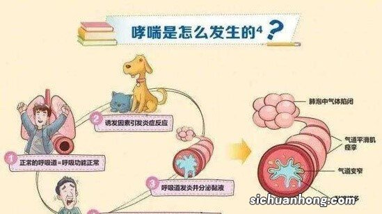 世界哮喘日是哪一天 世界哮喘日什么时候开始