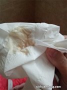 那些出血流褐色分泌物的孕妈别慌，说说我出血后成功保胎的经历