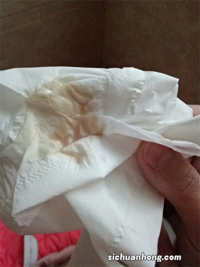 那些出血流褐色分泌物的孕妈别慌,说说我出血后成功保胎的经历