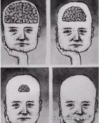 如果怀的宝宝智力低下，会表现出什么症状？