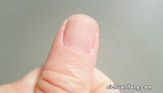 首度公开的掌纹医学秘密