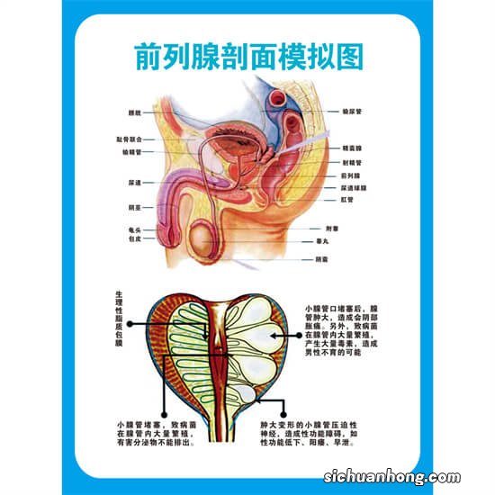 哪几个因素会导致患上前列腺炎?