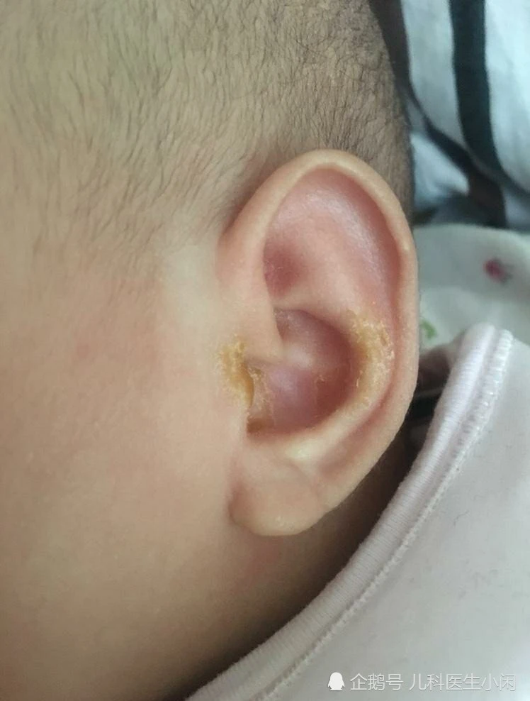 宝宝身上这几个地方不能清洗太干净,频繁清洗反而更容易生病