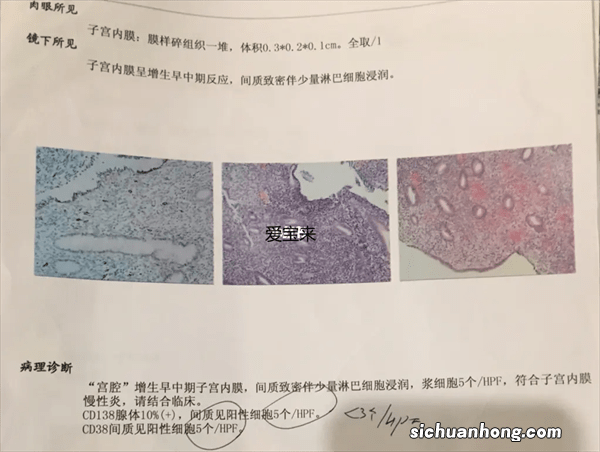 做什么检查才能知道宫腔是否粘连？