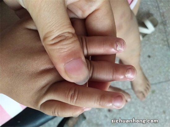 儿科医生从不告诉你,宝宝小指甲上竟藏有这些惊人的健康小秘密