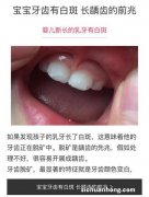 宝宝出牙睡不好觉怎么办