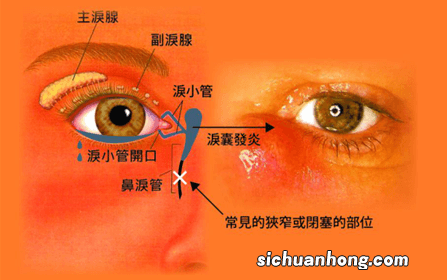 眼睛总流泪是怎么回事？