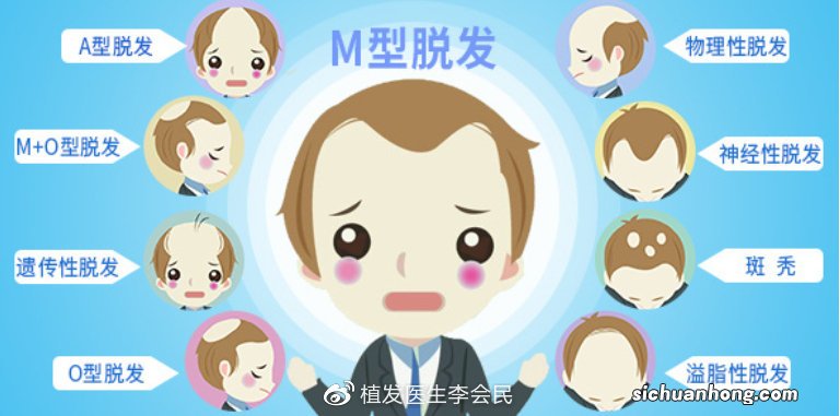 为何生活中我们总能看到谢顶的男人而不是谢顶的女人?