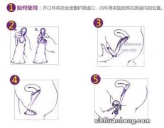 女性避孕最佳方案是什么？