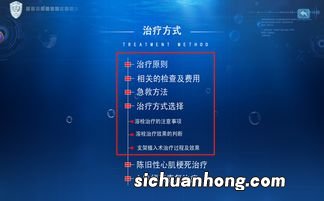 支架手术后,替格瑞洛吃多久才能停?