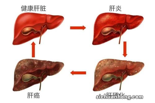 哪些人尤为需要警惕肝癌、肺癌和胰腺癌的发生？