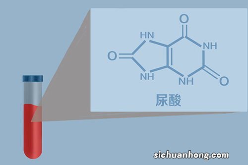 什么样的人尿酸容易超标？