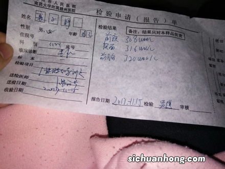 在家怎么测黄疸