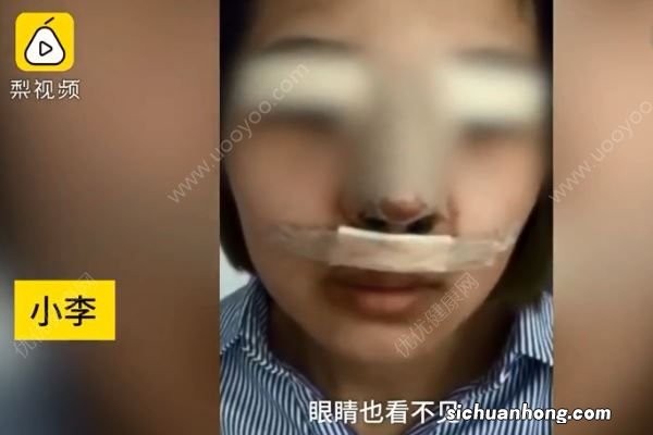 想当网络主播贷款3万整容，结果遭“毁容”