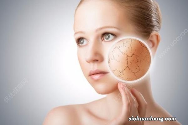 夏季皮肤干燥应该怎么办?怎样防治皮肤干燥问题?