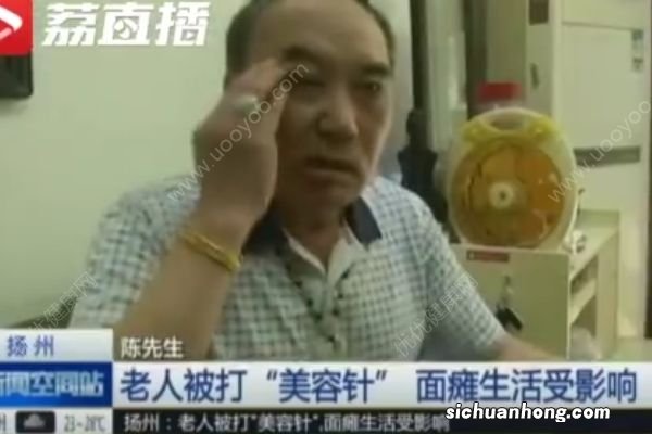 免费打美容针,六旬男子面瘫“没脸出门”