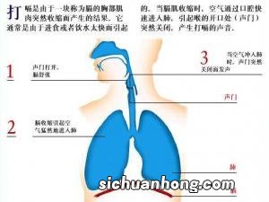 打嗝不止怎么办？打嗝偏方