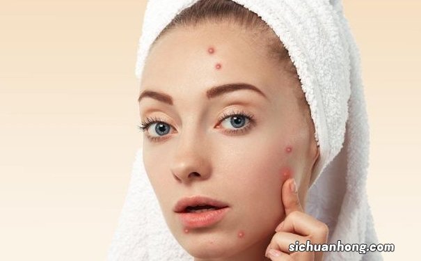 长出痘痘是什么原因导致的?为什么过了青春期还会长痘?