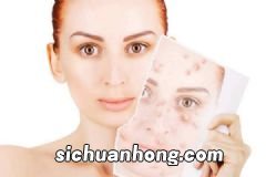 冬季怎么保养手部皮肤?冬天怎样防止手冻伤?