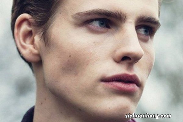 男人毛孔粗大是什么原因?如何改善毛孔粗大?