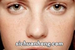 网购玻尿酸自行注射差点毁容玻尿酸千万别随便使用