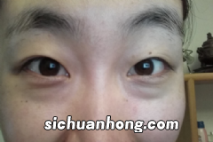 肌肤问题与健康有关这些可能是健康危险信号