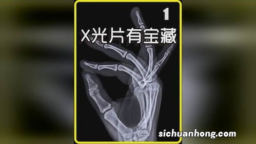 一公斤x光片能提炼多少白银